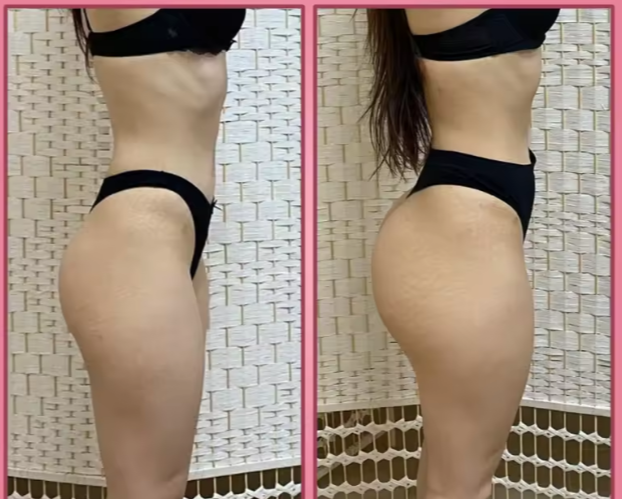 KIT MACA CURVE PLUS gélules 1000 mg Maca root - Résultats garantis - 100% plantes